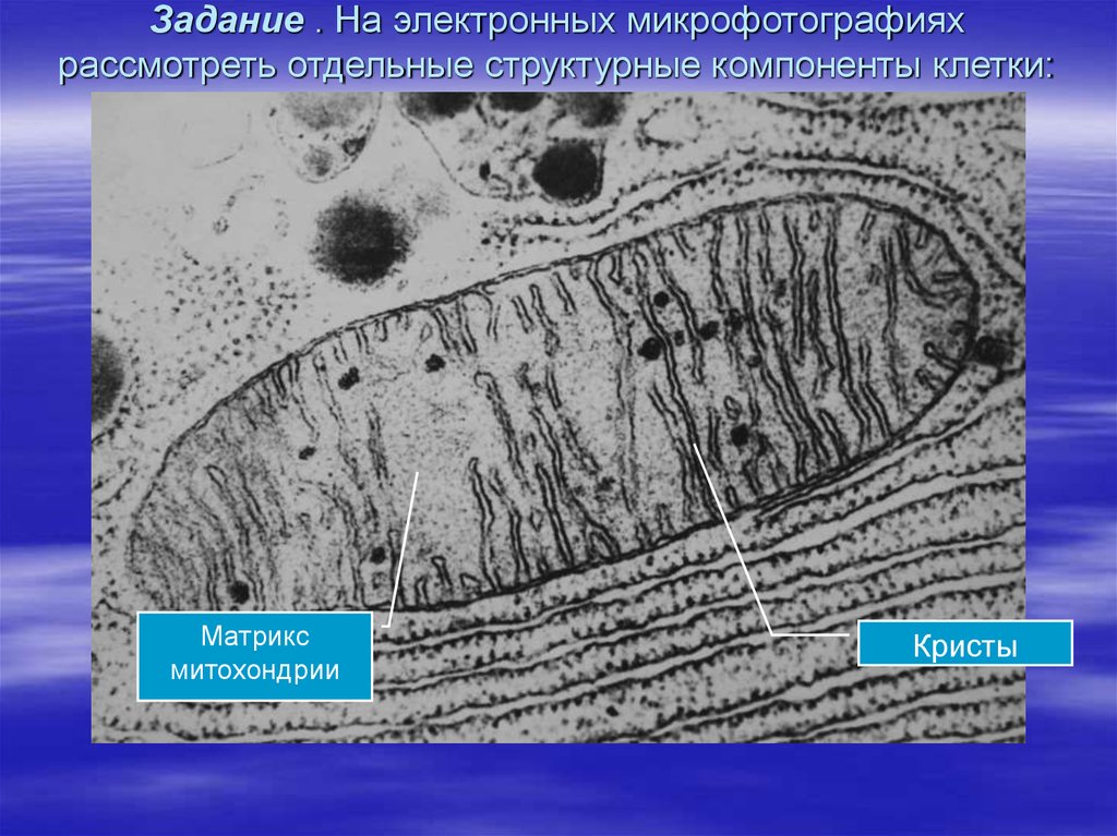 Какова функция органоида электронная микрофотография которого представлена на рисунке