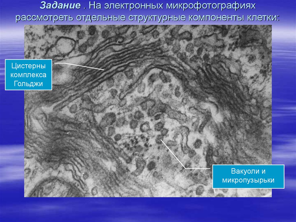 Рассмотрите световую микрофотографию. Аппарат Гольджи микроскоп. Комплекс Гольджи микрофотография. Аппарат Гольджи электронная микрофотография. Комплекс Гольджи электронная микроскопия.