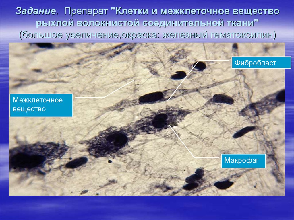 Межклеточное вещество соединительной ткани. Межклеточное вещество рыхлой соединительной ткани. Рыхлая волокнистая ткань межклеточное вещество. Межклеточное вещество рыхлой волокнистой. Межклеточное вещество рыхлой соединительной ткани препарат.