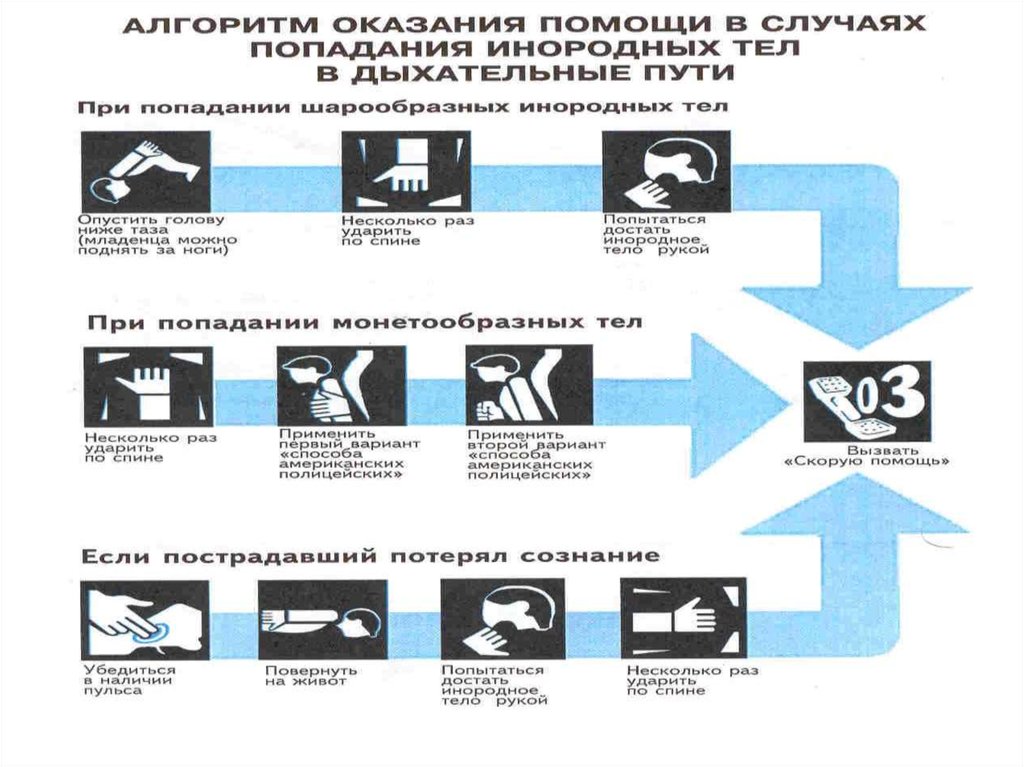 Первая помощь при попадании инородных тел в верхние дыхательные пути обж презентация