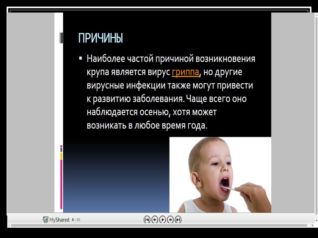 Круп у детей. Синдром крупа у детей презентация. Наиболее частая причина крупа у детей:. Причины возникновения крупа.