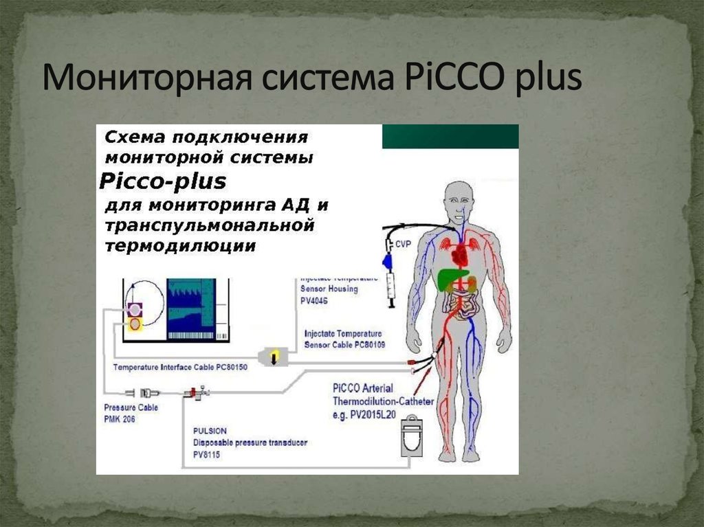 Мониторная система PiCCO plus