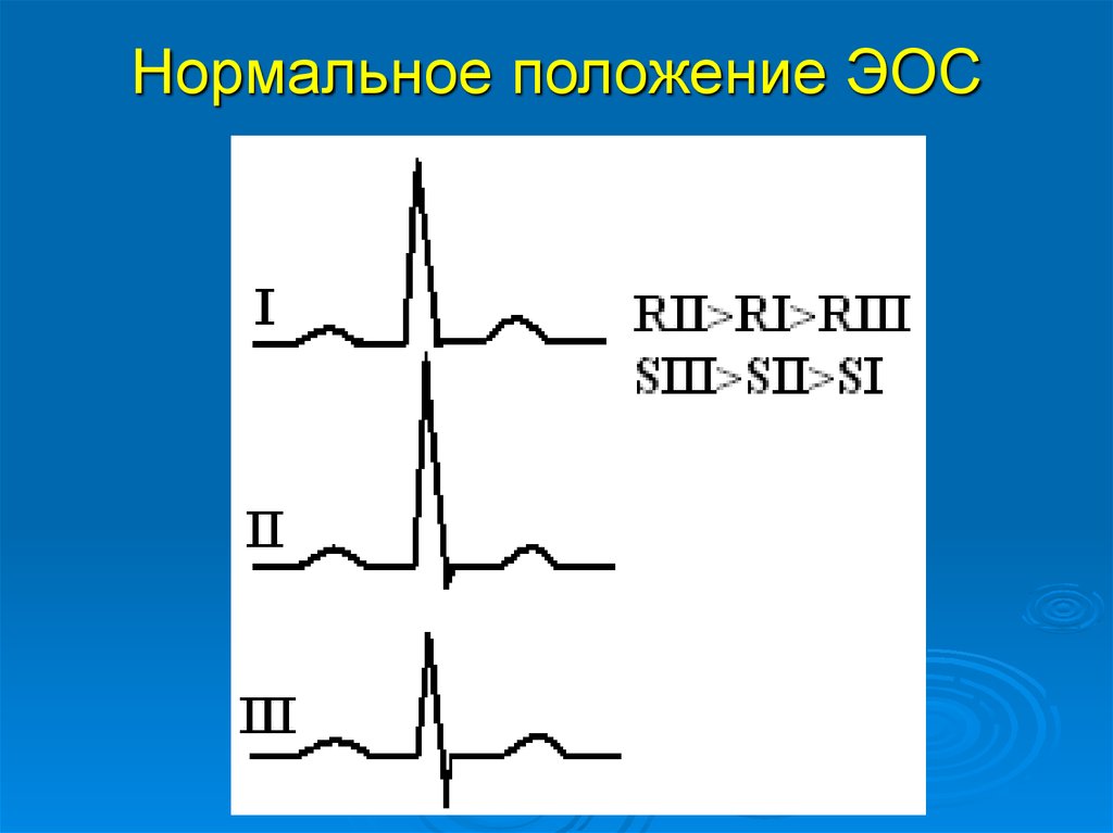 Горизонтальное положение эос