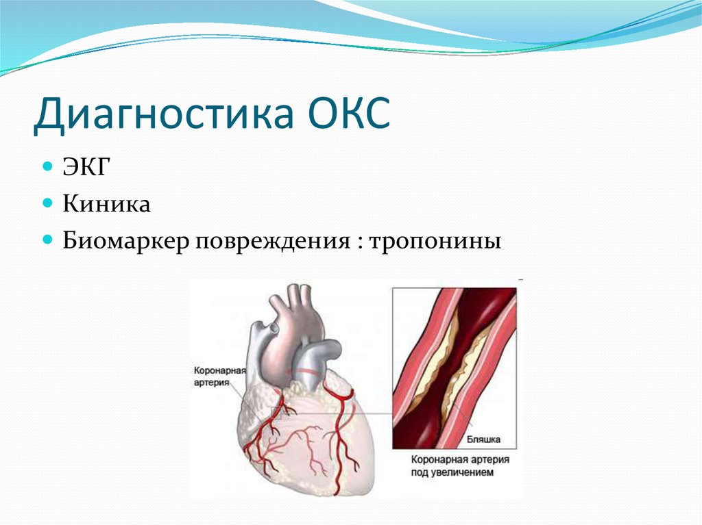 Окс картинки для презентации