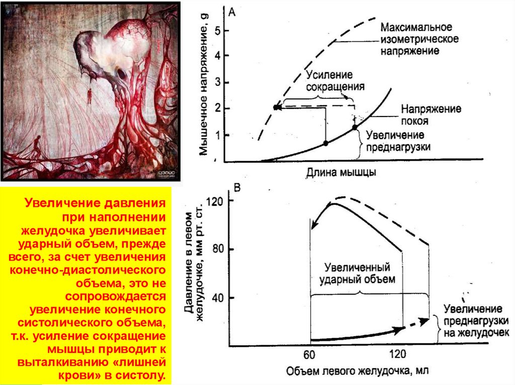 Увеличение желудочка. Диаграммы зависимости ударного объема от конечно диастолического. Конечный систолический и конечный диастолический объем. Увеличение систолического давления. Конечно диастолический объем желудочков.