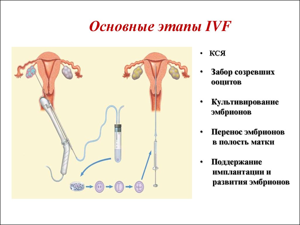 Перенос эмбриона форум