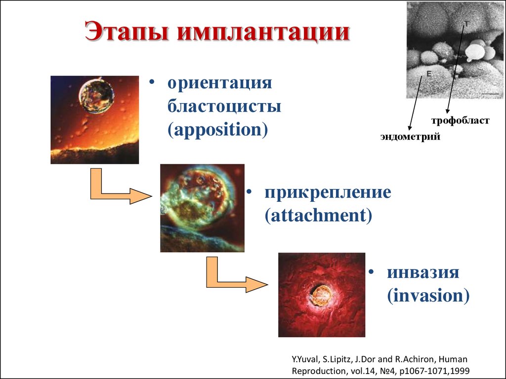 Имплантация в матку симптомы