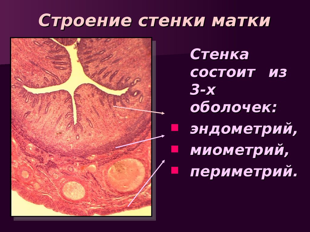 Слизистая стенок матки. Эндометрий миометрий периметрий. Стенка матки состоит из 3 слоев. Слои стенки матки (оболочки). Слои стенки матки анатомия.