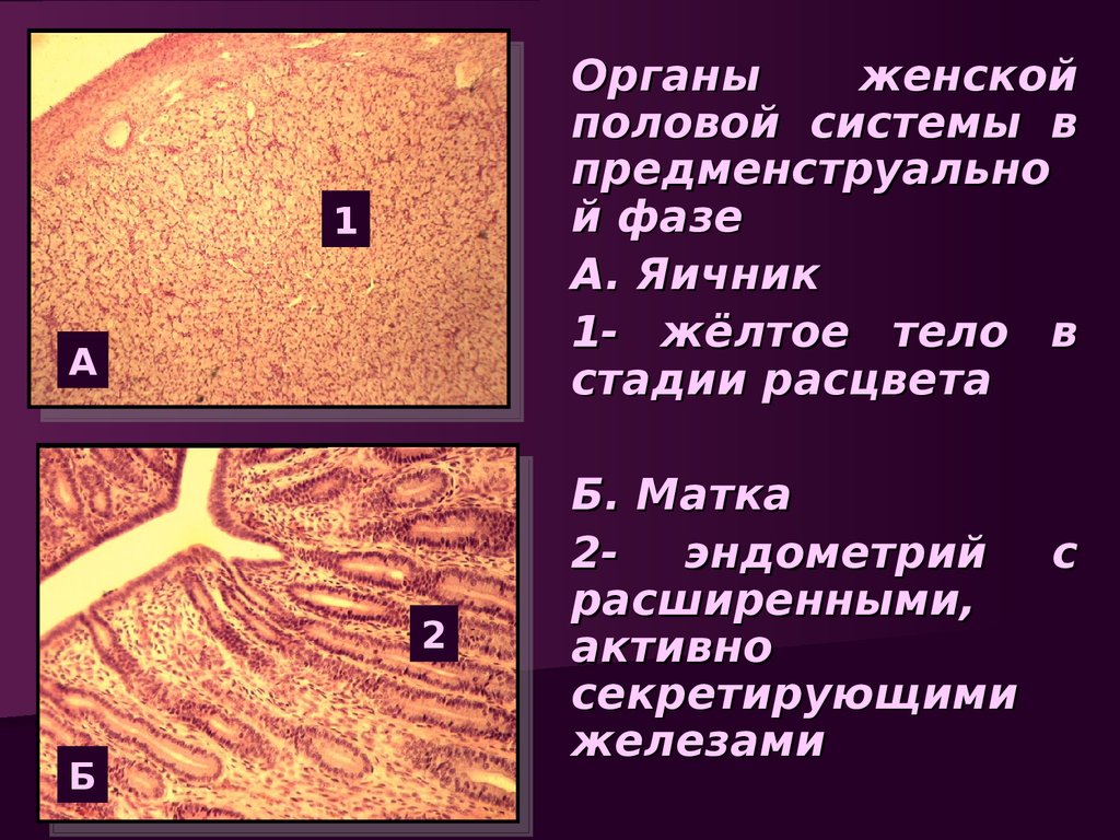 Образование женских половых. Стадия расцвета желтого тела. Секретирующий эндометрий. Желтое тело в фазе расцвета. Женская половая система.