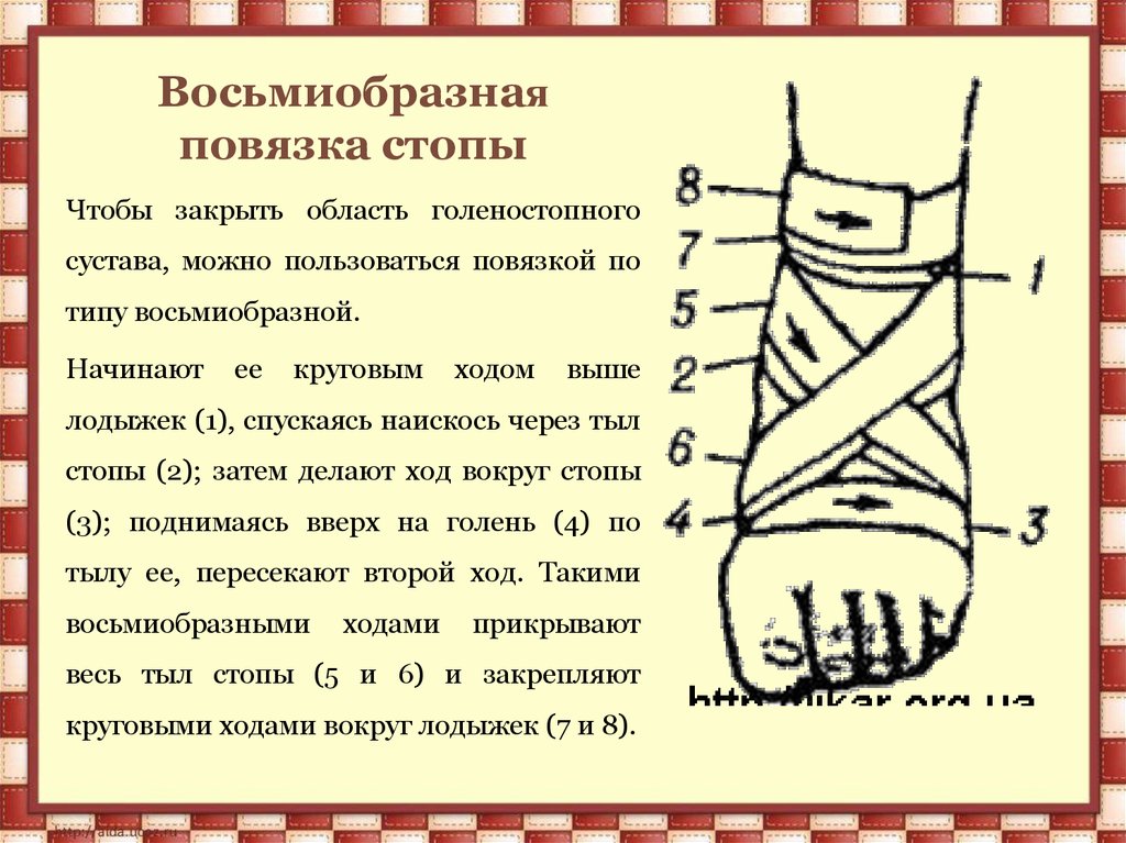 Горин почему повязка на ноге 7 класс презентация