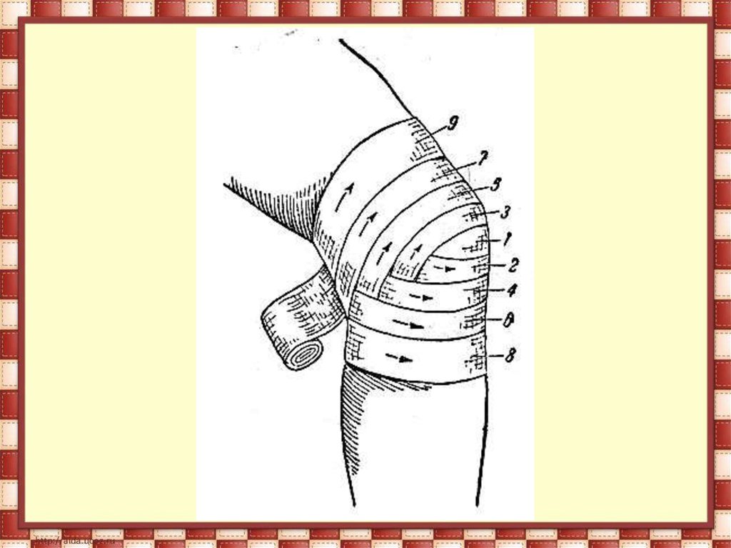 Правила наложения повязок презентация обж 7 класс