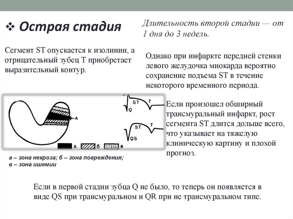 Нижний инфаркт с подъемом