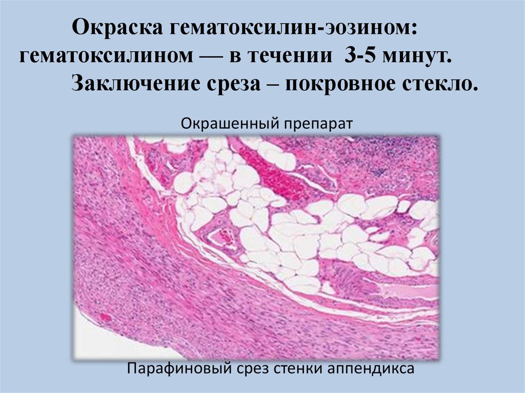 Изменения в тканях