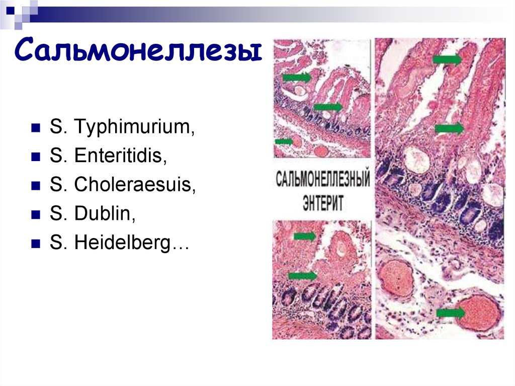 Сальмонелла энтеритидис. Сальмонеллез морфология. Salmonella choleraesuis возбудитель. Salmonella Enteritidis вызывает.