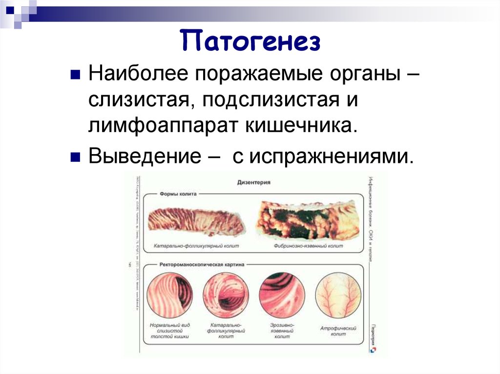 Слизистый орган. Какие отделы кишечника наиболее часто поражаются при шигеллезе. Органы поражения Фостен. Наиболее поражаемая система органов.