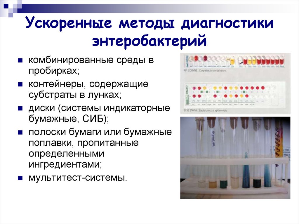 Методы исследования среды. Лабораторная диагностика энтеробактерий микробиология. Бактериологический метод исследования энтеробактерий. Система индикаторных бумаг микробиология. Микробиологическая диагностика энтеробактерий.