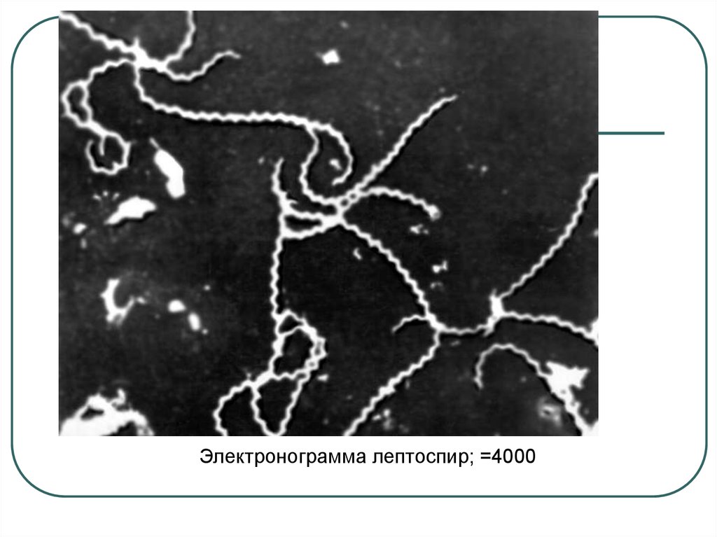 Спирохеты вызывают заболевания. Спирохеты эндофдагеллы. Ультраструктура спирохет. Спирохеты рисунок микробиология. Таксономия спирохет микробиология.
