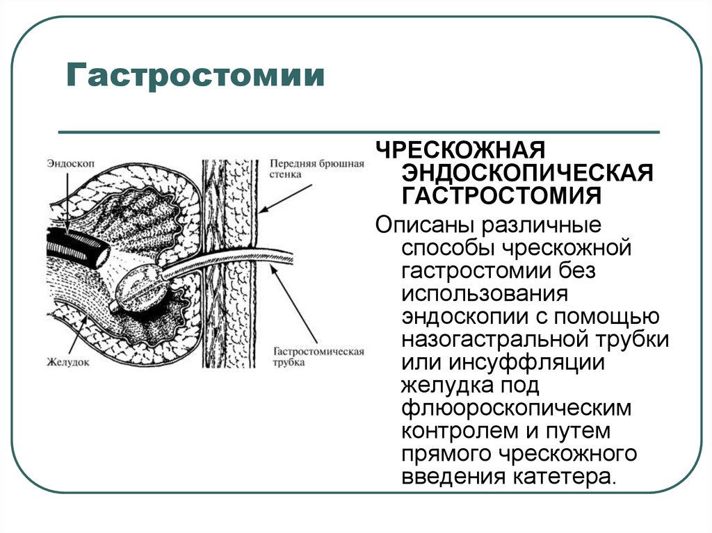 Тесты по топографической анатомии