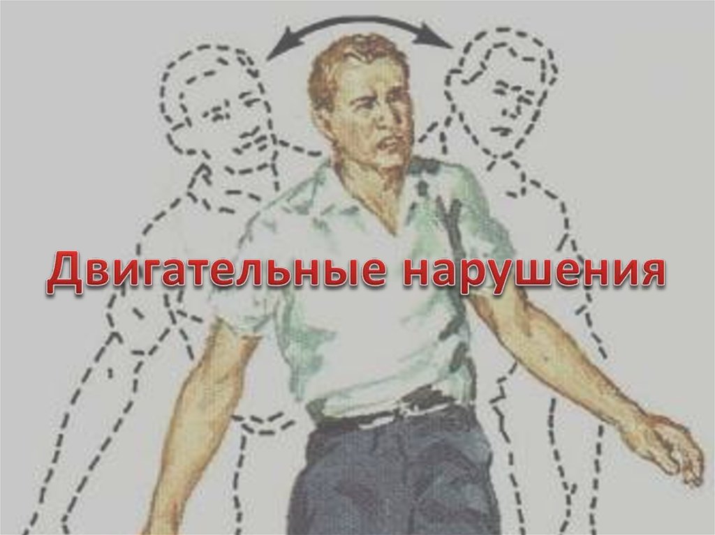 Основные двигательные нарушения