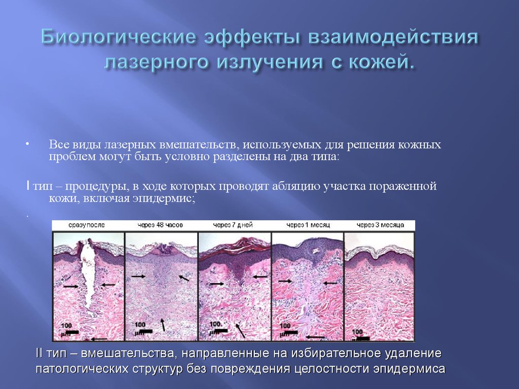 Биологические эффекты взаимодействия лазерного излучения с кожей.