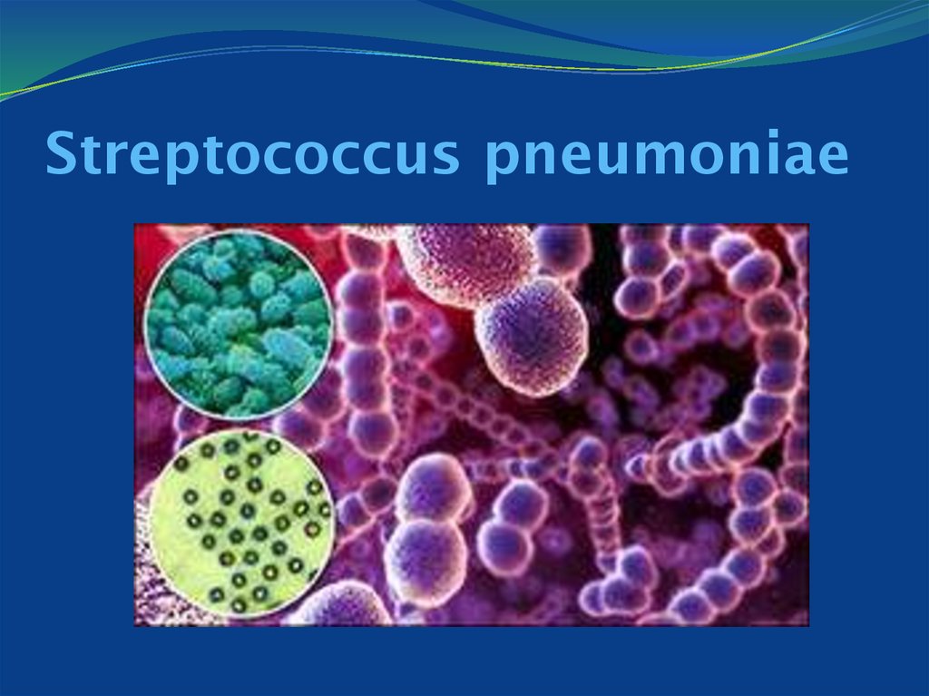 Streptococcus pneumoniae