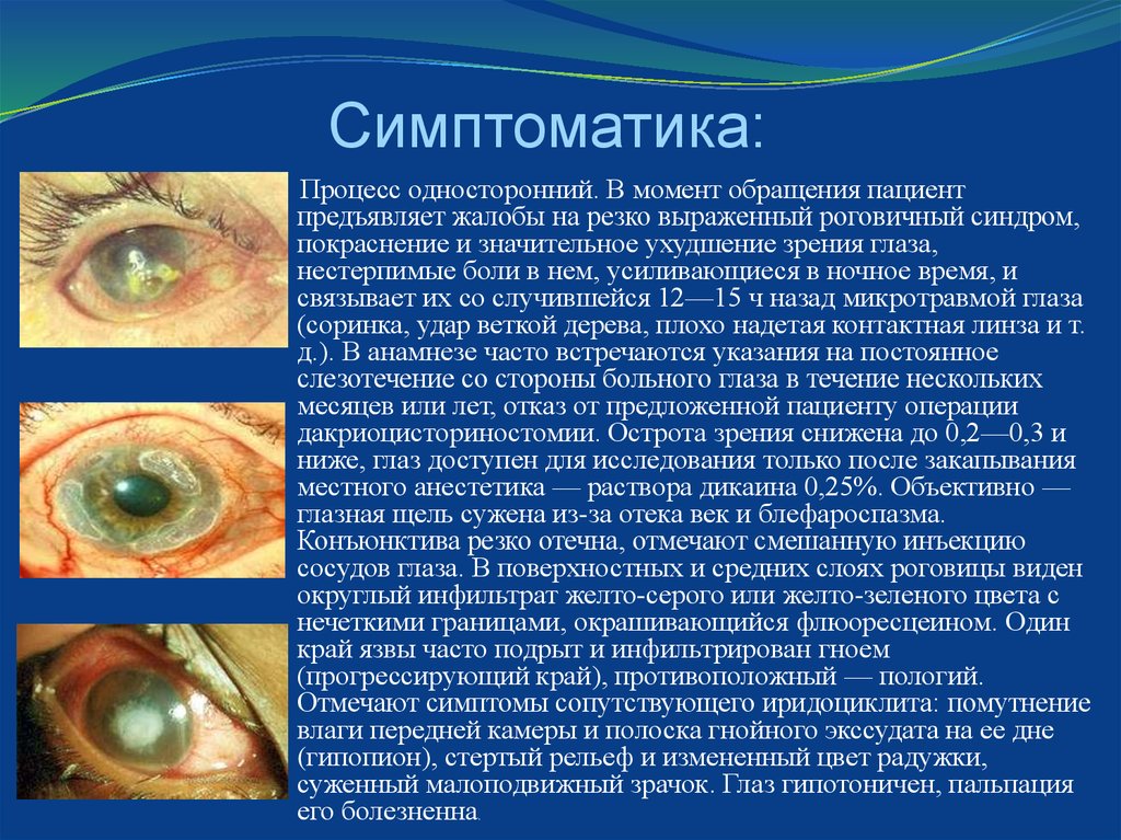 Симптоматика: