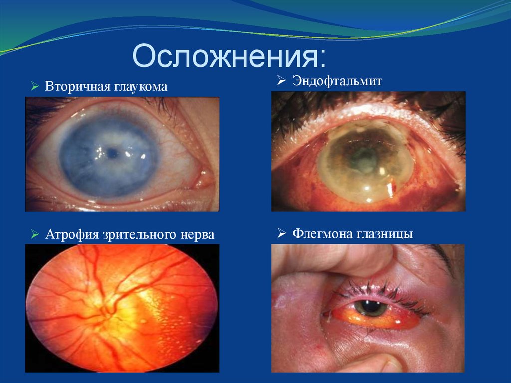 Осложнения: