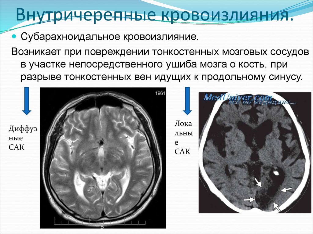 Повреждения головного мозга возникают