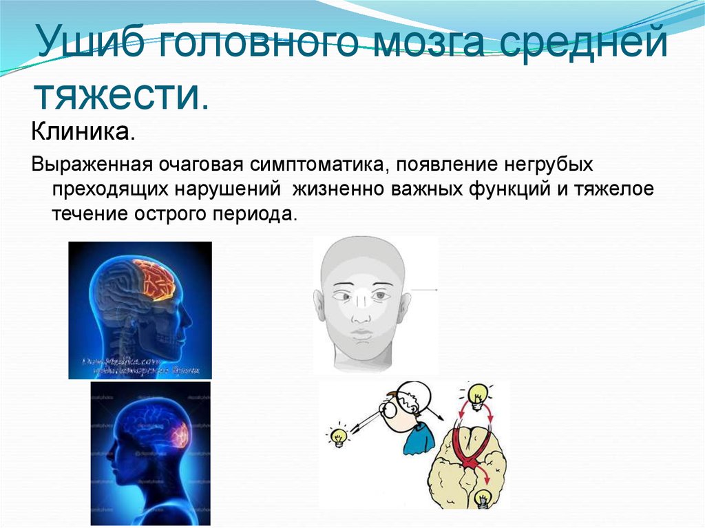 При сотрясении головного мозга наблюдается. Ушиб мозга средней степени. Ушиб головного мозга средней тяжести. Ушиб головного мозга средней степени тяжести. ЗЧМТ ушиб головного мозга средней степени тяжести.