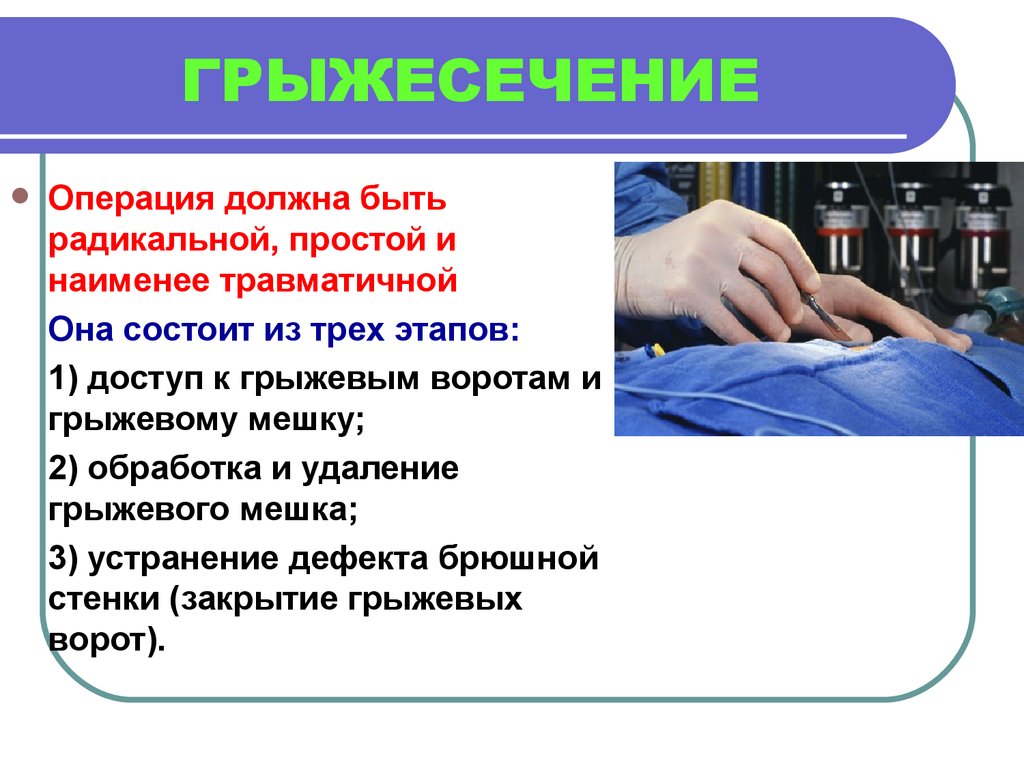 Операции должны быть выполнены в. Операция грыжесечения. Этапы операции грыжесечения. Герниопластика этапы операции. Грыжесечение паховой грыжи.