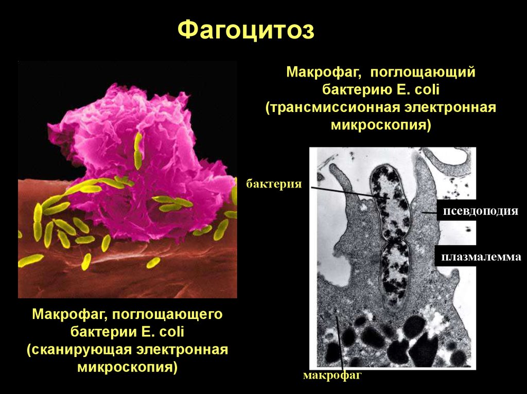 Макрофаги фагоцитоз. Фагоцитоз микрофаги и макрофаги. Макрофаги электронная микроскопия. Фагоцитоз бактерий. Макрофаг фагоцитоз бактерию.