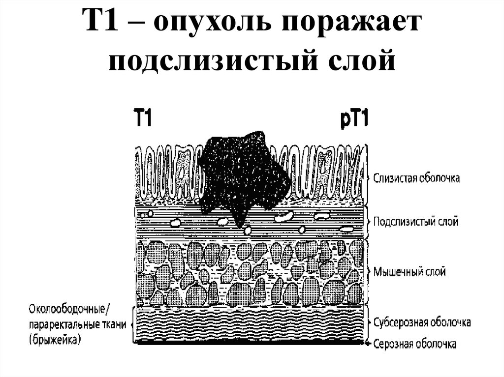 Строение слизистой оболочки полости рта. Подслизистый слой. Мышечная оболочка желудка латынь. Подслизистая оболочка. Слизистый и подслизистый слой.