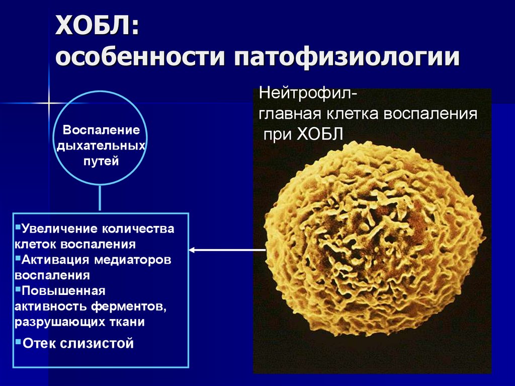 Бронхит хобл. Особенности ХОБЛ. ХОБЛ медиаторы воспаления. ХОБЛ патофизиология. Хронический бронхит патофизиология.