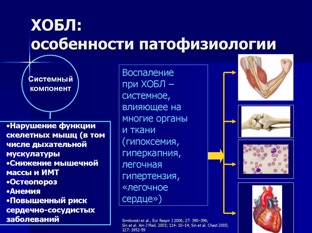 Хронический бронхит хобл. Хронический бронхит пропедевтика. Воспаление при ХОБЛ.