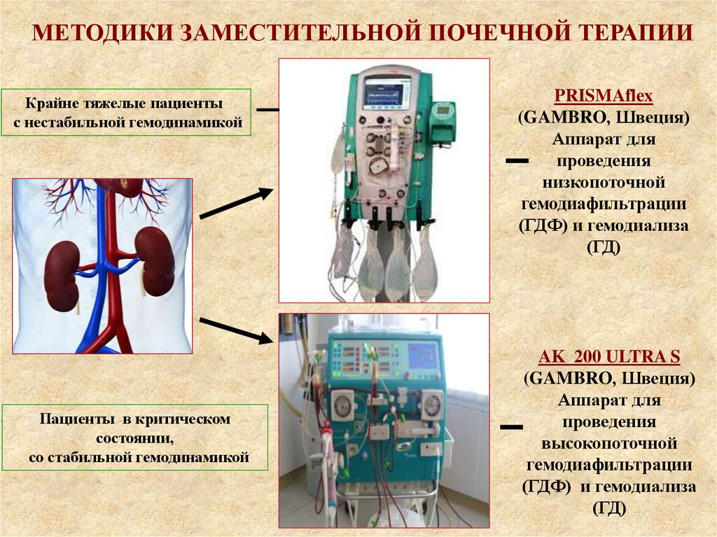 Заместительная почечная терапия презентация