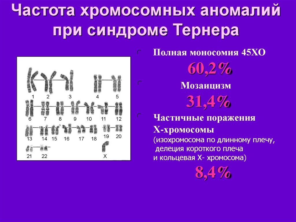 Кольцевая хромосома 2. Кольцевая хромосома. Хромосомная делеция короткого плеча. Моносомия по у хромосоме. Делеция плеча хромосомы.