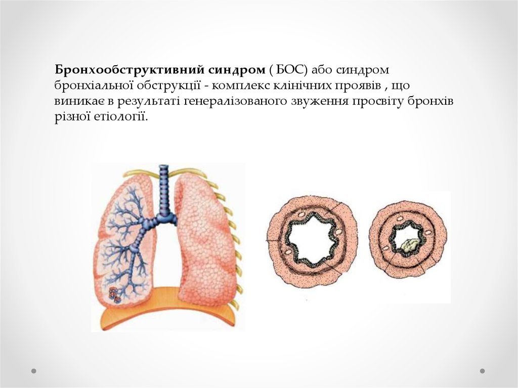 Бронхообструктивный синдром презентация казакша