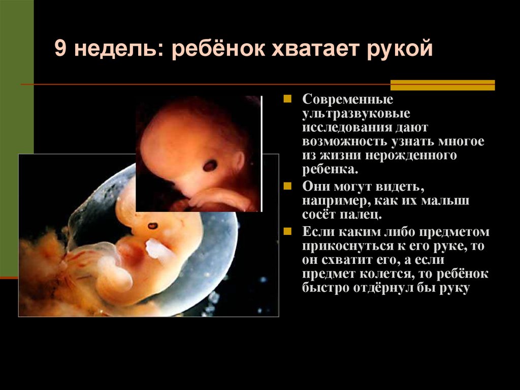 Эмбрион на какой неделе. Размер плода на 9 неделе беременности акушерской. Размер ребенка на 9 неделе. Размер ребенка на 9 неделе беременности. Размер эмбриона на 9 неделе.
