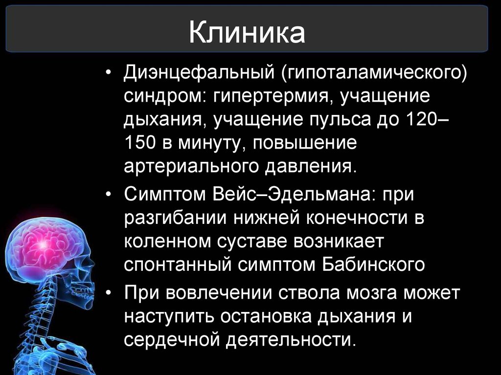 Диэнцефальная дисфункция головного мозга. Гипоталамические синдромы. Диэнцефальные синдромы. Клиника гипоталамического синдрома. Диэнцефально гипоталамический синдром.