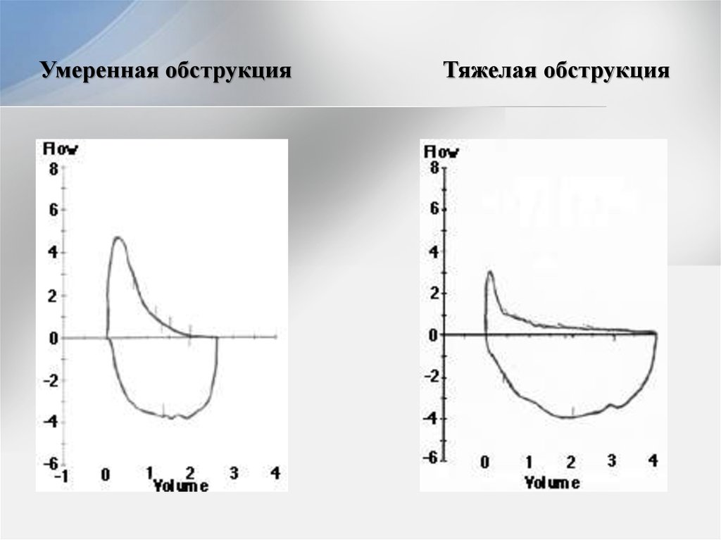 Спирография с сальбутамолом