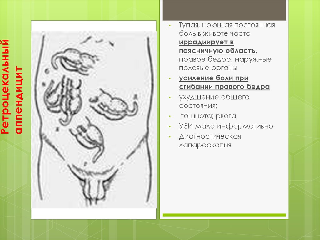 Боли иррадиирующие в прямую кишку. Тупая боль в животе. Тупая ноющая боль. Тупая ноющая постоянная боль в желудке. Постоянная ноющая боль в желудке.