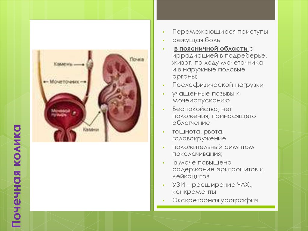 Как болят мочеточники симптомы