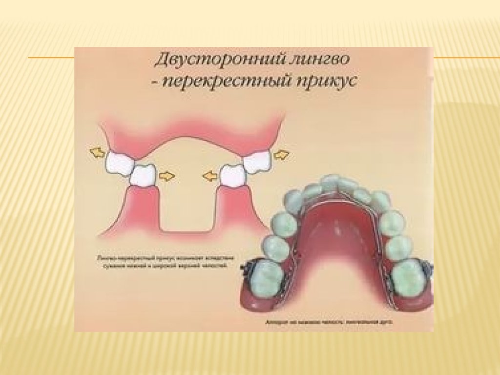 Перекрестный