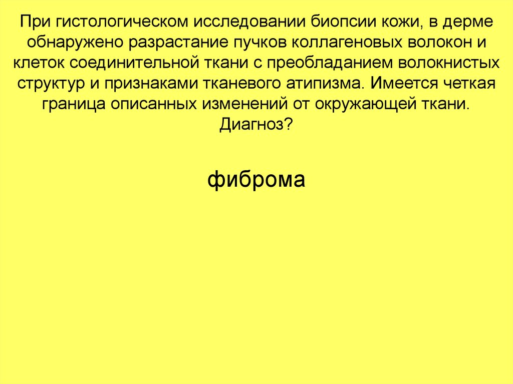 При гистологическом исследовании биопсии кожи, в дерме обнаружено разрастание пучков коллагеновых волокон и клеток соединительной ткани 