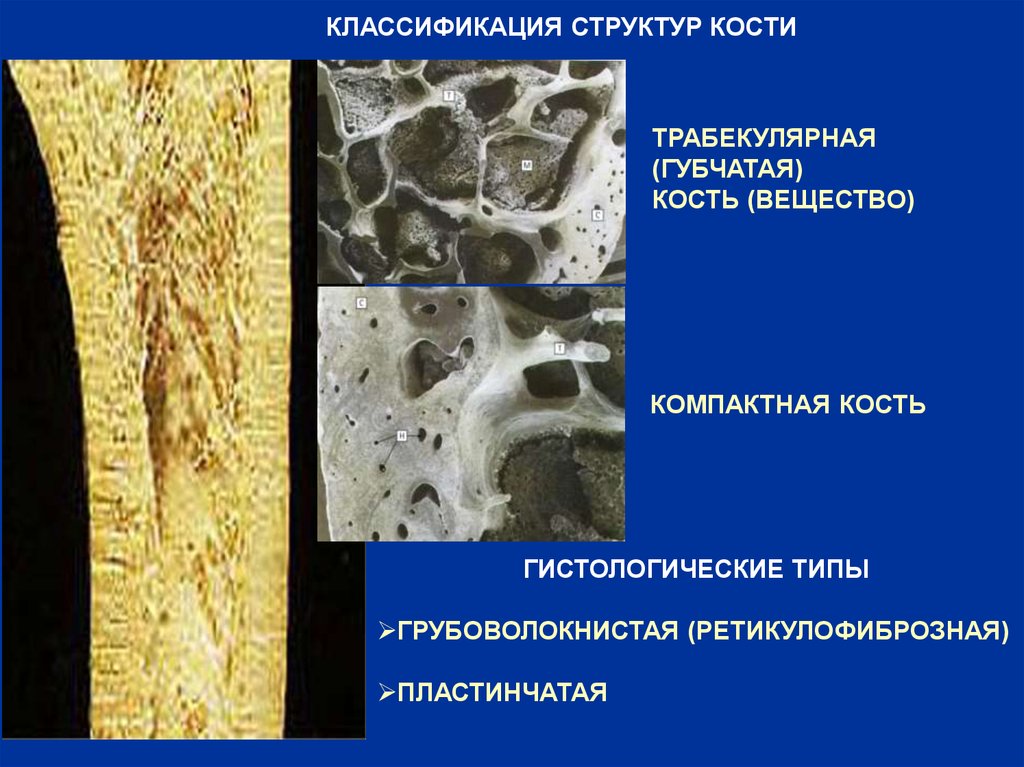 Состав костной ткани. Пластинчатая губчатая костная ткань. Пластинчатая трабекулярная костная ткань. Костная ткань компактное вещество губчатое вещество. Губчатая и компактная костная ткань.