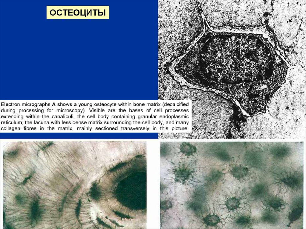 Остеоцит. Остеоциты микроскопия. Клетки остеоциты. Остеоцит органеллы. Остеоцит морфология.