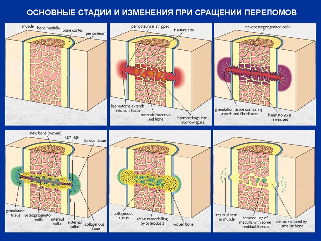 Стадия тканей. Регенерация костной ткани схема. Стадии регенерации костной ткани. Костная ткань регенерирует. Фазы сращения костной ткани.