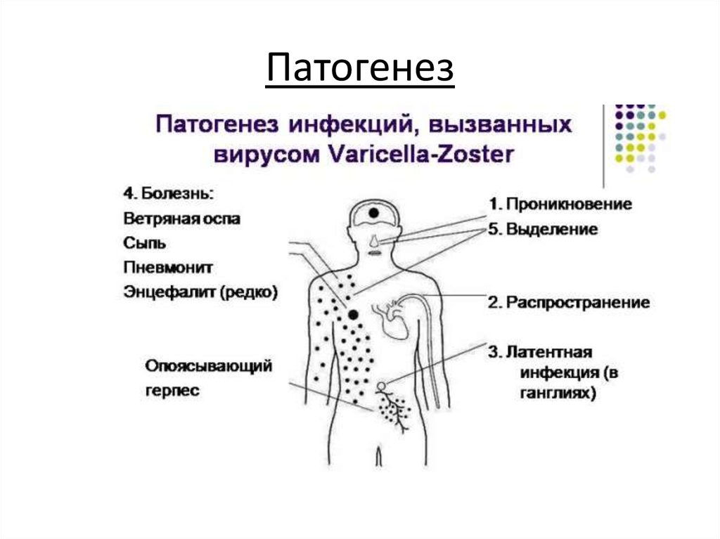 Патогенез кори схема