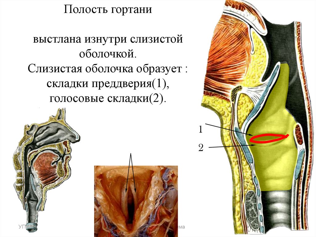 Связка преддверия гортани. Голосовые связки анатомия гортани. Слизистая оболочка гортани анатомия. Слизистая оболочка гортани выстлана. Голосовая складка гортани анатомия.