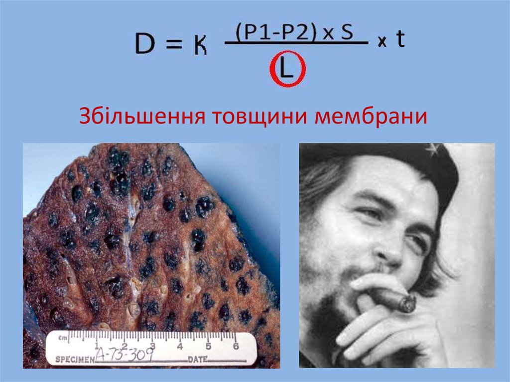 Збільшення товщини мембрани